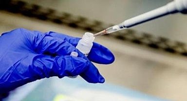 Dr. Özsevimli'den maymun çiçeği virüsü hakkında açıklama