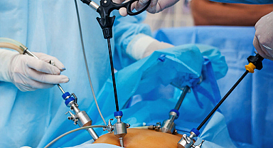 SAU'den Obeziteye Bilimsel Çözüm 